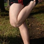 ACL Injury ACL Rupture